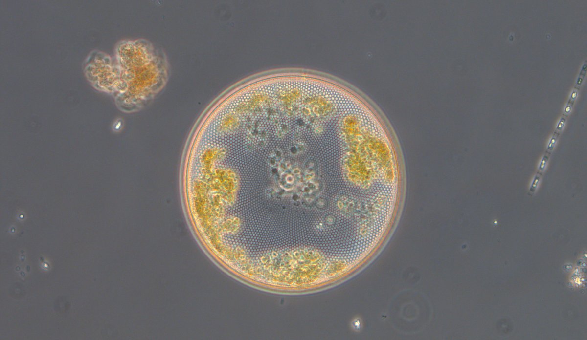Mikroskopbilde som viser et plankton med sirkelform, som rett og slett ser ut som en liten jordklode.