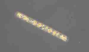 Mikroskopbilde som viser et langt og tynt stokk-lignende plankton.