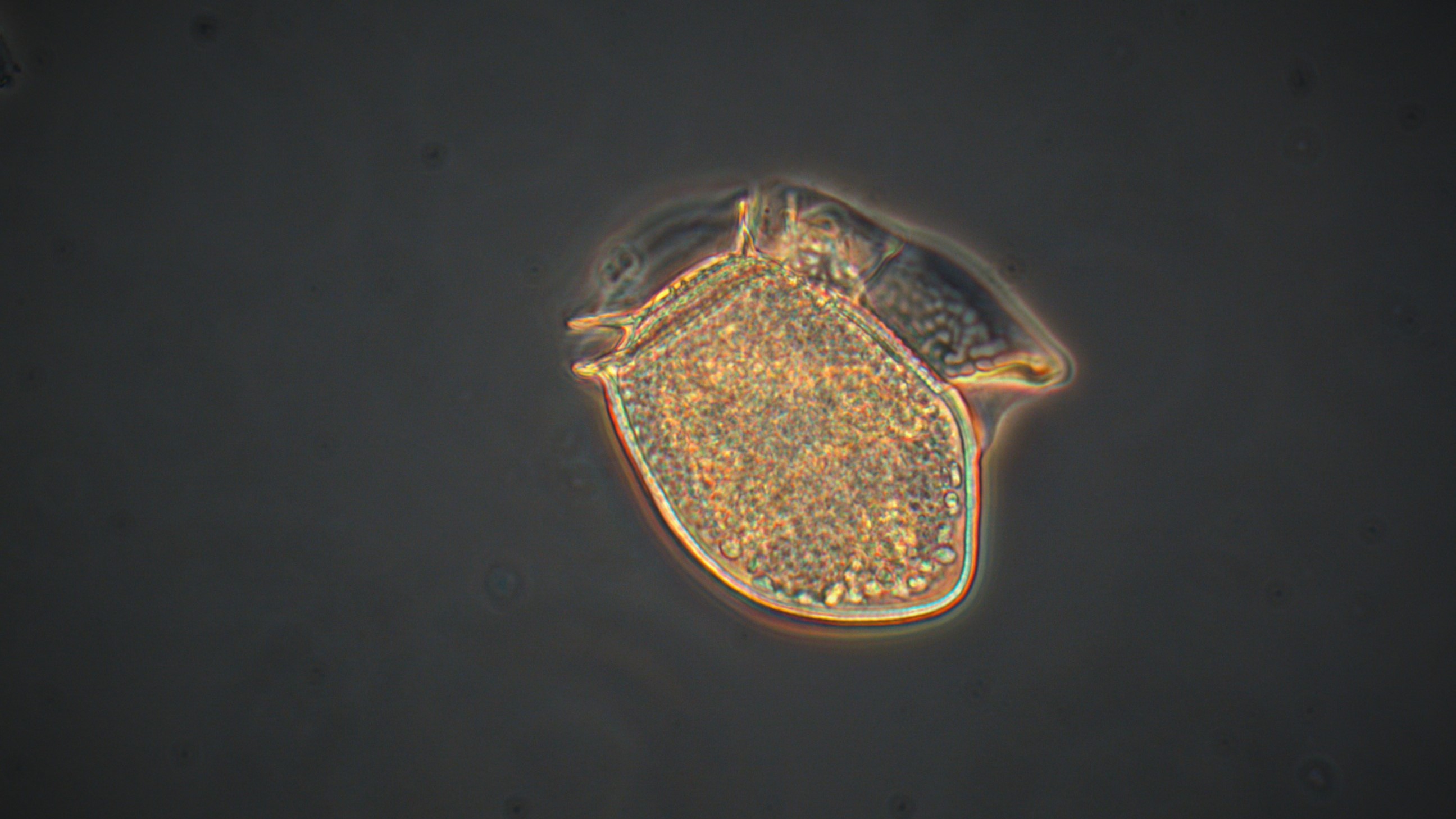 Nærbilde av algen Dinophysis acuta