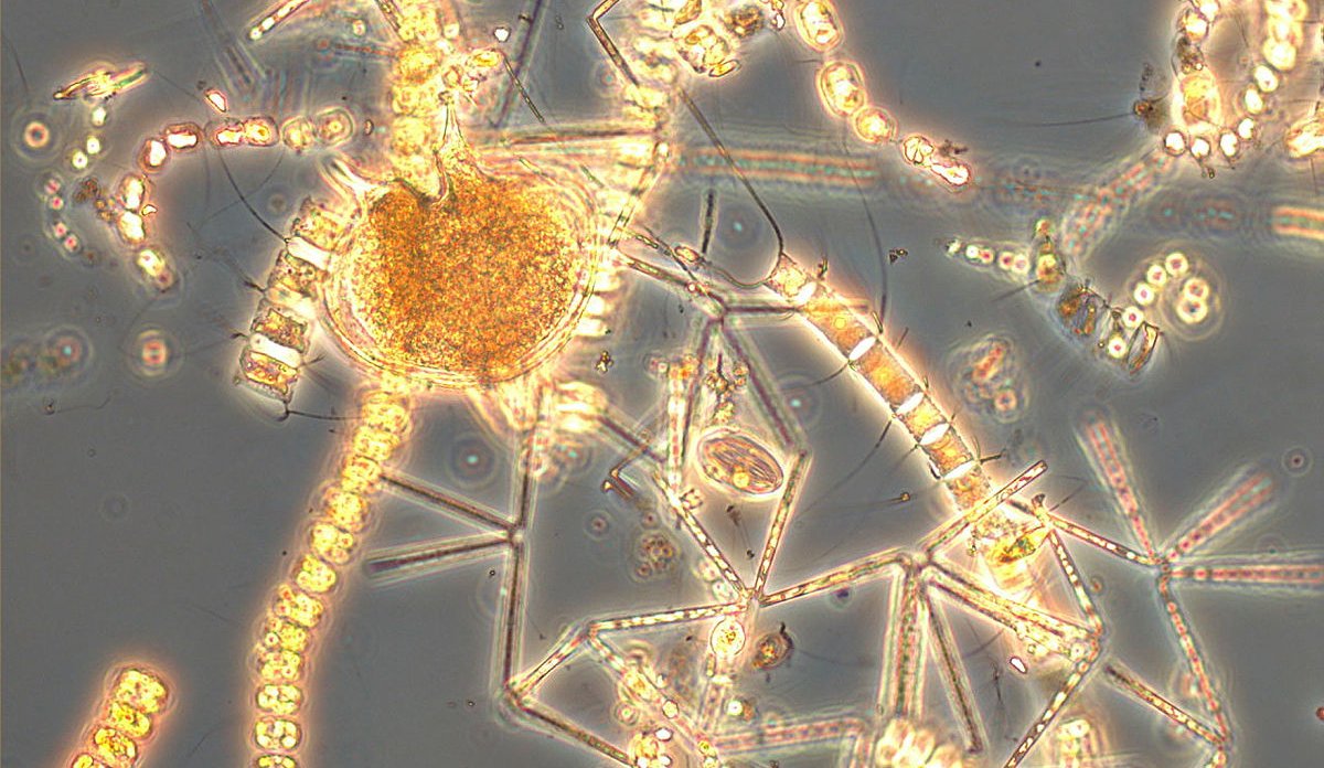 
Oversiktsbilde kiselalger og protoperidinium, mikroalger.