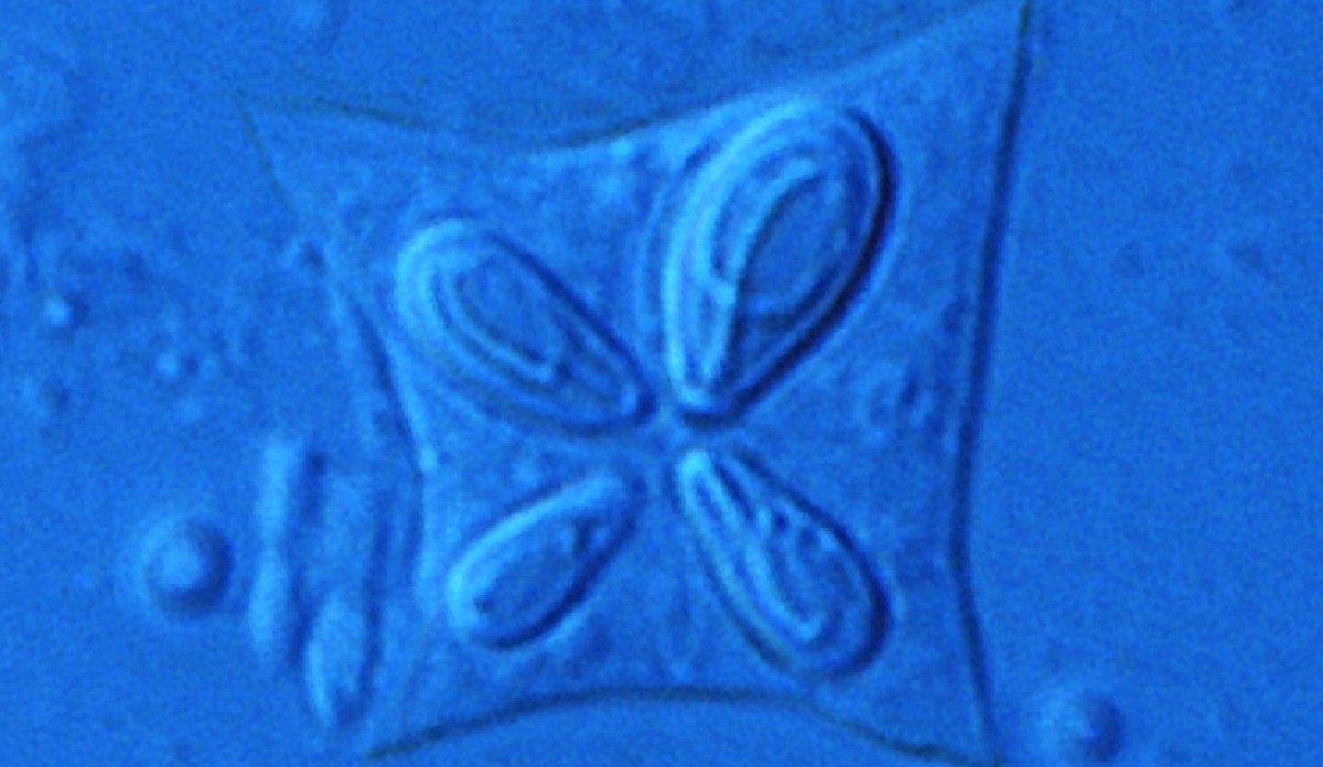 Gelémakrell-parasitten Kudoa thyrsites (10 µm)