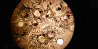 

Hvilesporer og hyfer i en makrellnyre sett gjennom et mikroskop