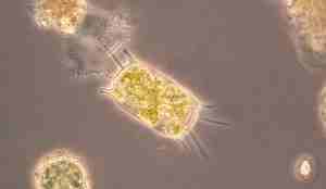 Mikroskopbilde som viser et rektangelformet plankton med pigger stikkende ut.