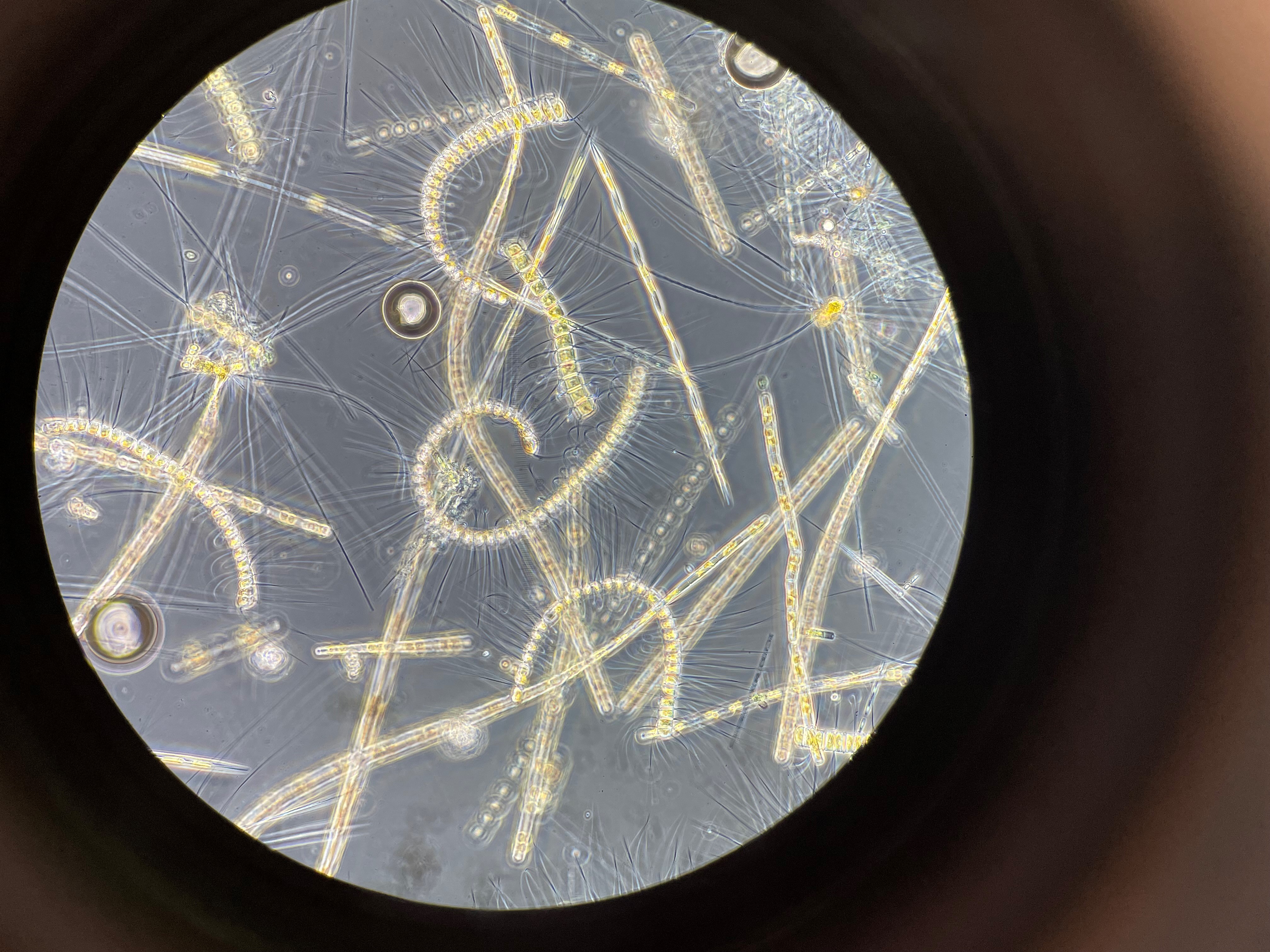 Mikroskopbilder av alger som ser ut som trådformede staver 