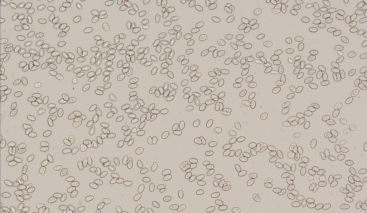 Blodceller av laks under mikroskop. I motsetning til pattedyr, som har røde blodceller uten cellekjerne, har fisk røde blodceller med cellekjerne og DNA.