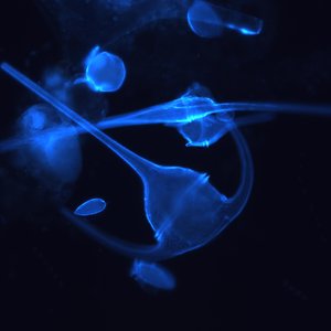 fluorisert dinoflagellat.jpg