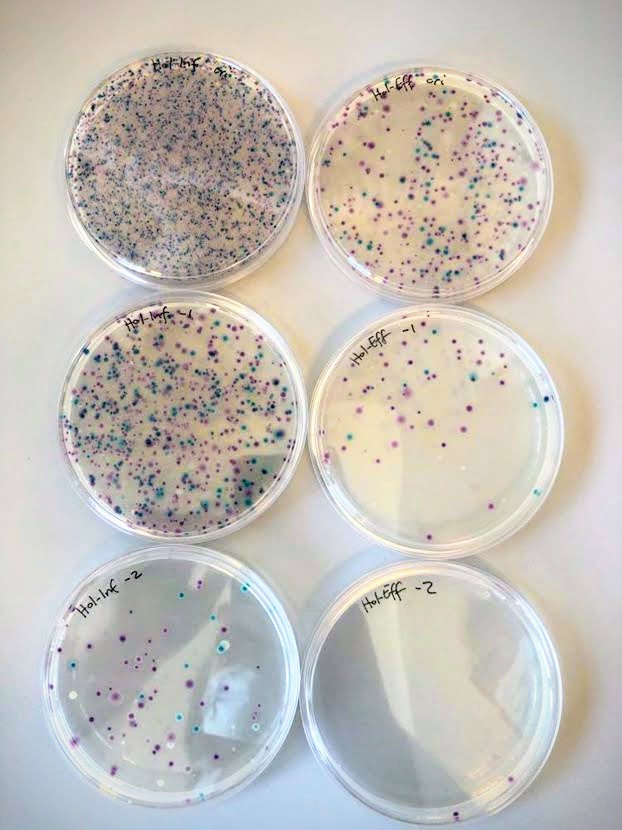 foto av petriskåler med bakterievekst