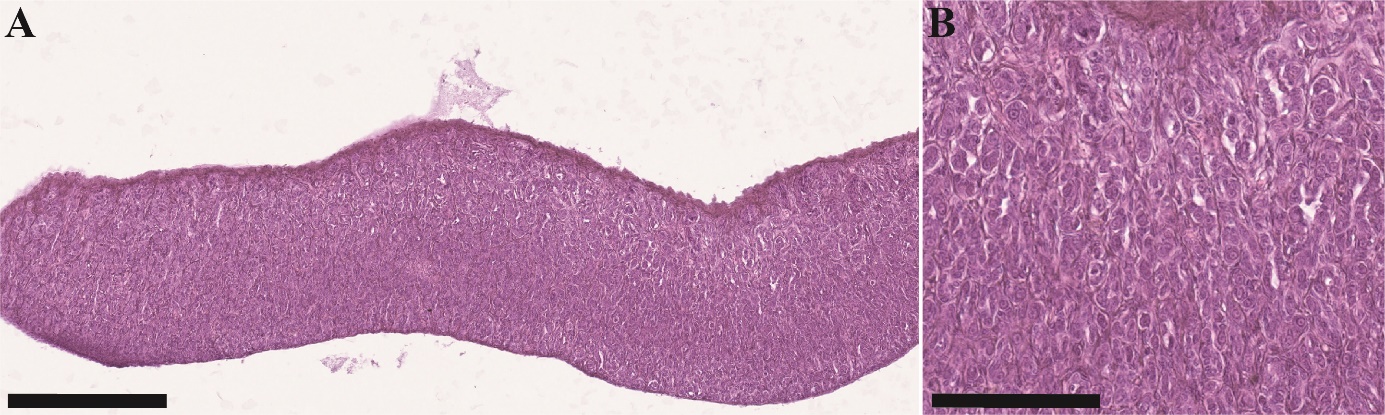 Figuren viser to bilder av histologiske snitt av gonadevev fra en hanntorsk i ulike forstørrelser. Hos denne umodne fisken observeres spermatogonier.