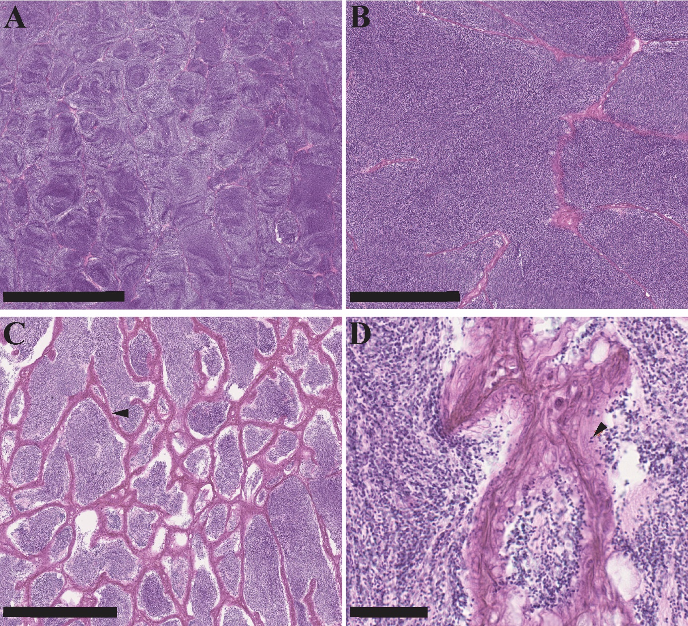 Figuren viser fire bilder av histologiske snitt av gonadevev fra en hanntorsk, tatt fra ulike steder i vevet og i forskjellige forstørrelser. Bildene viser hovedsakelig spermatozoer, men også fagocyterte frie spermatozoer og tykke interlobulære vegger. Fisken er klassifisert i stadium 3: gytende hanntorsk.