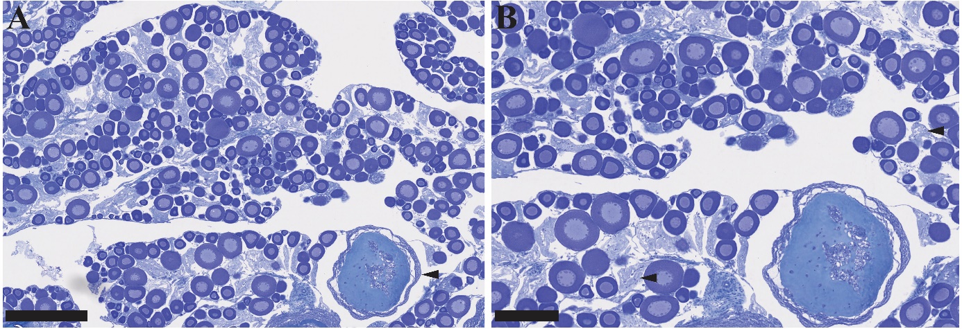 Figuren viser to bilder av histologiske snitt av gonadevev fra en hunntorsk i ulike forstørrelser. Bildene viser previtellogene oocytter, inkludert noen oocytter i atresi. I tillegg observeres mange follikler etter ovulering. Dette indikerer at fisken er i ferd med å avslutte gytingen.