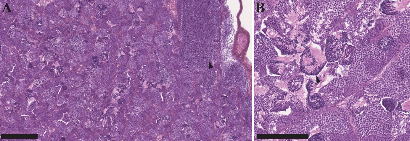 Figuren viser to bilder av histologiske snitt av gonadevev fra en hanntorsk i ulike forstørrelser. Bildene viser forskjellige stadier av modning av kjønnscellene, med de minst utviklede cellene i periferien av lobben og de mest utviklede nær efferentkanalen. I de mest avanserte stadiene observeres spermatozoer.