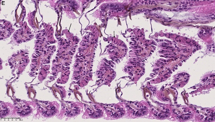 Figure 3. E) High number of secretory cells (black arrow) and hyperplasia of the epithelial cells, HES stained, NDP view 2, 40X (HAMAMATSU Photonics). 