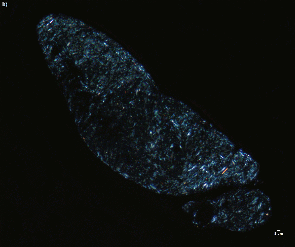 Figure 2.  b) The same specimen as in figure a) examined under darkfield polarized interference microscope (Leica), NDP view 2, 40x (HAMATSU Photonics)