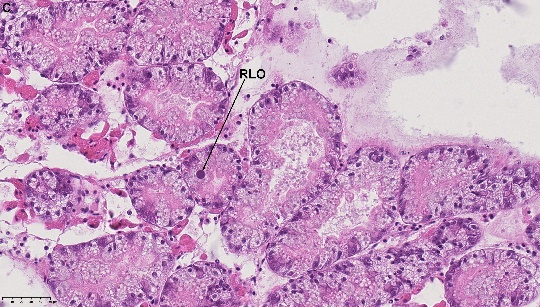 Figure 2. C) RLO in the digestive tubule. NDP view 2, 40x (HAMATSU Photonics)