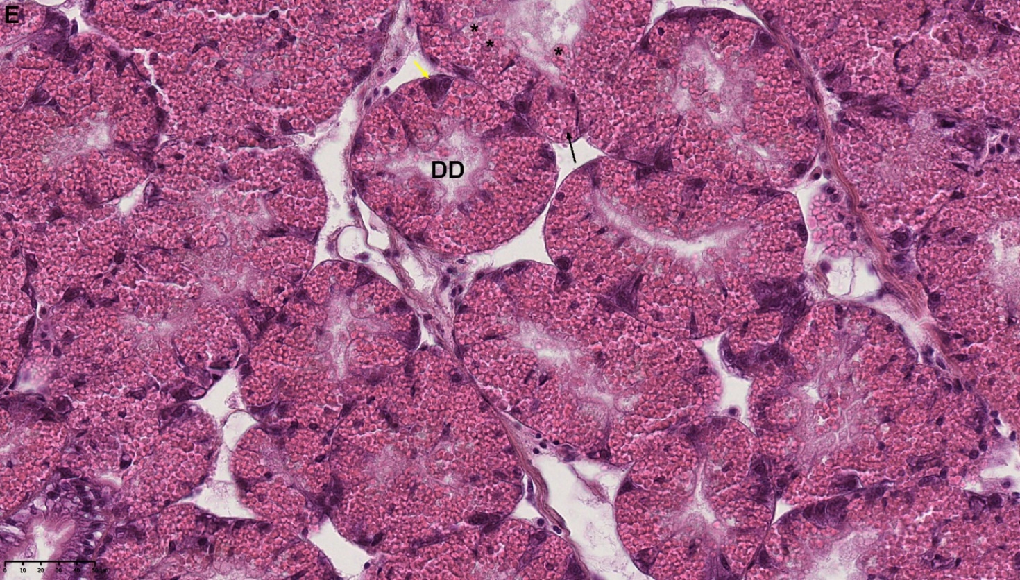 Figure 1. E) Normal tubules filled with lysosomes in the digestive cells; basophilic cells (yellow arrow); digestive cell (black arrow); the lysosomes appear to be released into the lumen in some tubules (Asterix). HES stained. NDP view 2, 40X. 