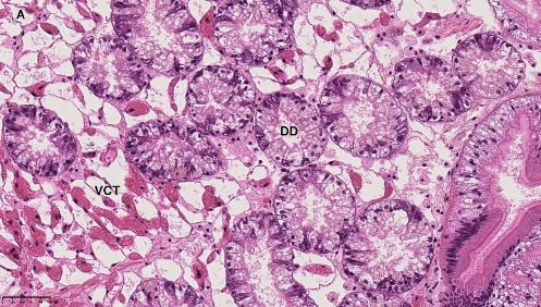 Figure 1. A) Normal DG; VCT: Vesicular connective tissue; DD: Digestive diverticula. HES stained. NDP view 2, 40X. 