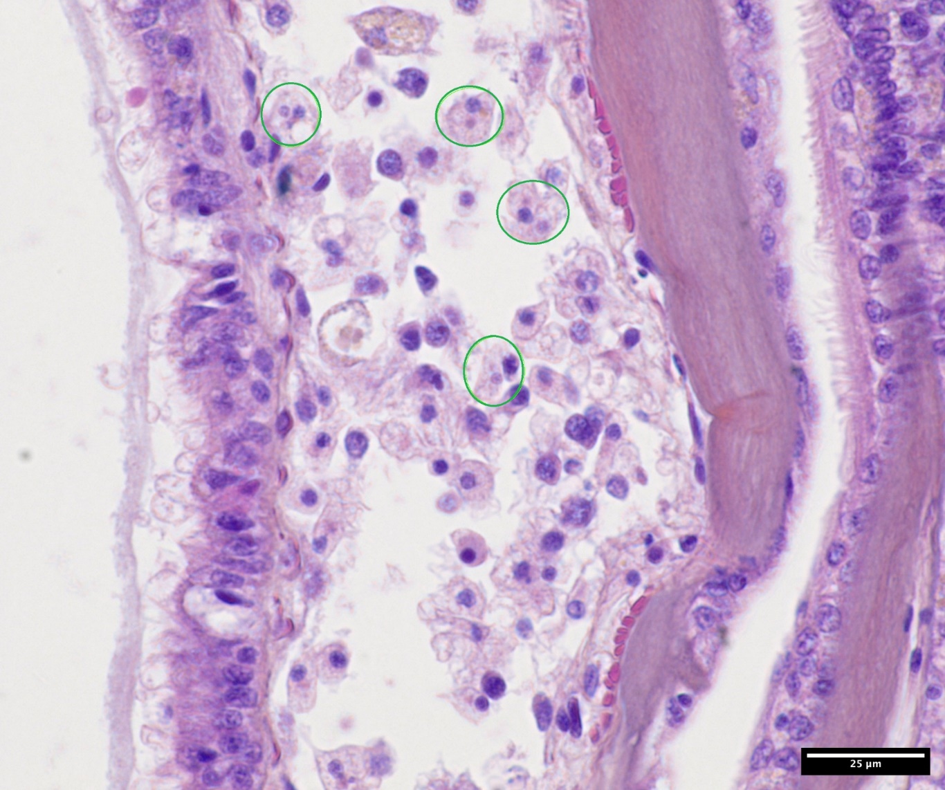 Image from microscopical examination of oyster tissue with haemocytes with microcells